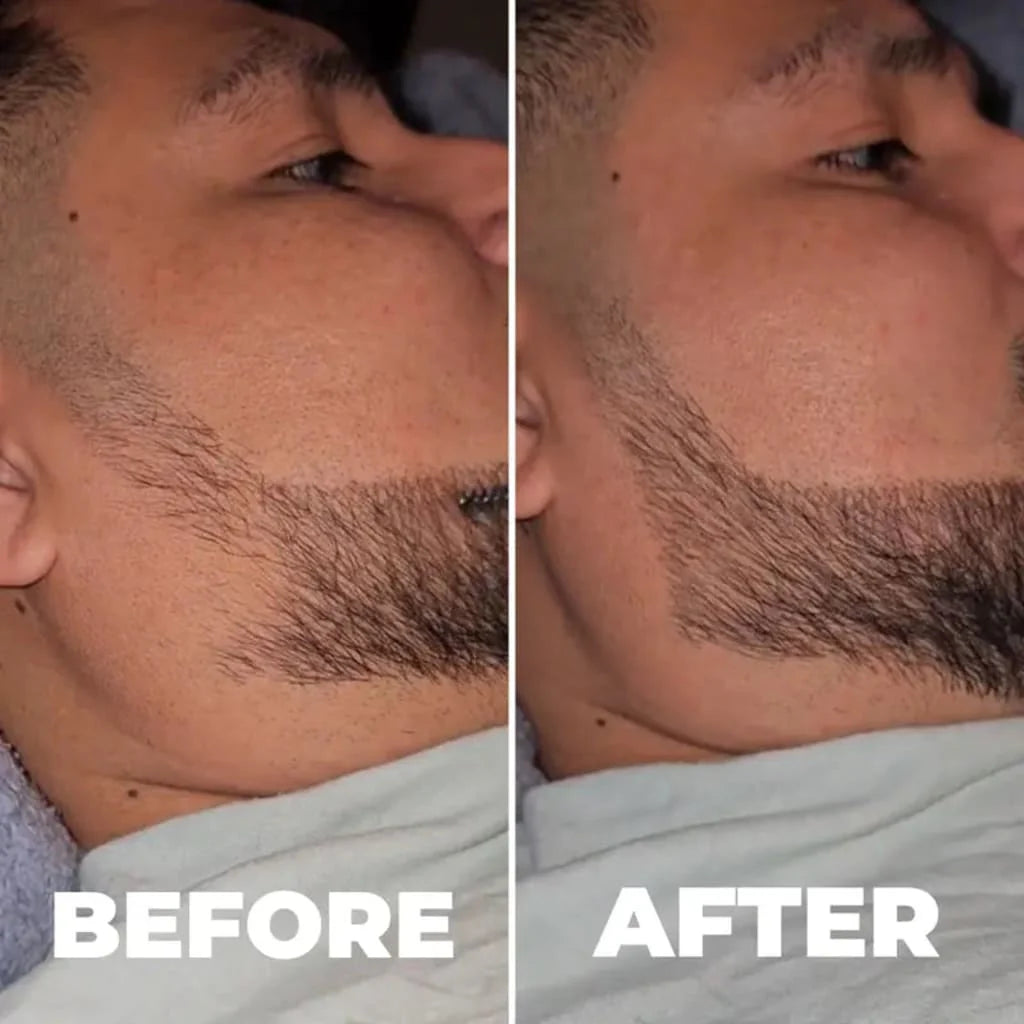 TrimLine™ Beard Filler Pen Kit