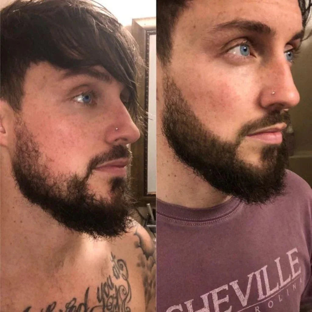 TrimLine™ Beard Filler Pen Kit