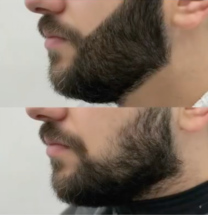 TrimLine™ Beard Filler Pen